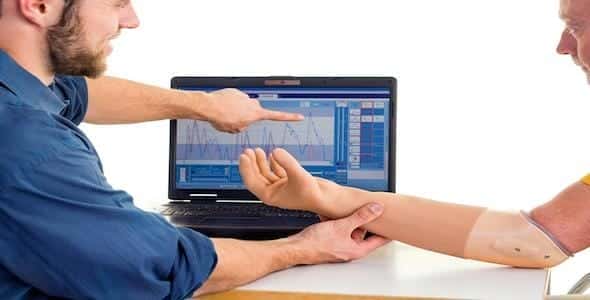 A person points at a graph on a laptop screen, sharing important information, while another holds a prosthetic arm resting on the table.