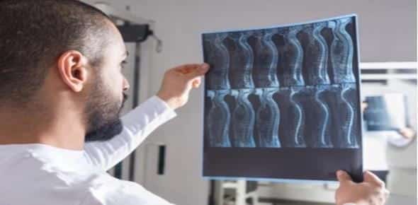 A person, potentially a lawyer specializing in spinal cord injury cases, carefully examines X-ray images held up against the light, possibly analyzing evidence for a Detroit car accident claim.